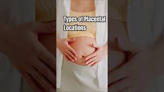 Placental Locations pregnancy placentapositionduringpregnancy [upl. by Anirac]