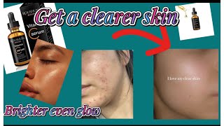 Honest review on Roushun vitamin c serumHow to brighten ur face complexionskincareglow beautiful [upl. by Ydwor]