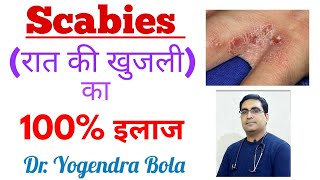 Scabies  ka complete treatment in hindi  scarab scabilice lotion permite 5 vermact 12 mg tab [upl. by Ynffit932]