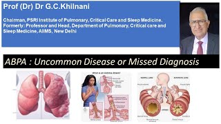 ABPA Uncommon Disease or Missed Diagnosis GC Khilnani [upl. by Anoli]