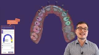 【软件发布】exocad DentalCAD 3 2 Elefsina｜Dental Forever [upl. by Argile239]