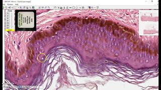 Keratinized stratified squamous epithelium [upl. by Hunger]