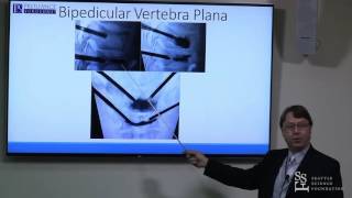 Vertebral Augmentation Pedicular Approach  Neal Shonnard MD [upl. by Doowyah992]