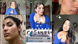 How to use tretinoin 0025 my journeyE2 tretinoin tretinoincream myjourney acnetreatment [upl. by Moule]