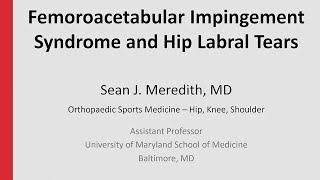 Femoroacetabular Impingement Syndrome and Hip Labral Tears [upl. by Airekahs]