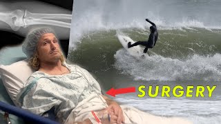 I Tore My BICEP Muscle OFF THE BONE while Surfing [upl. by Ashling]