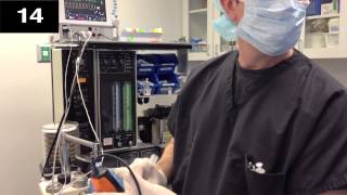 Timed tracheal intubation with video laryngoscope [upl. by Neelasor260]