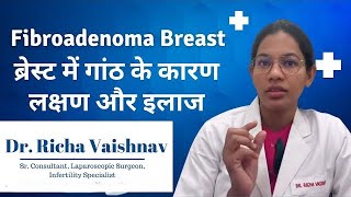 Fibroadenoma Breast  ब्रेस्ट में गांठ के कारण लक्षण और इलाज । [upl. by Erasme505]