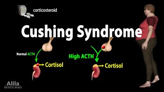 Cushing Syndrome Animation [upl. by Ripp]