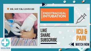 How to Perform Endotracheal Intubation A Clinical Demonstration [upl. by Revorg]