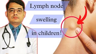 Lymph node swelling in childrenLymphadenopathyCause symptoms treatment [upl. by Macmullin]