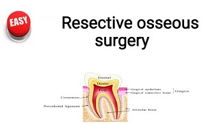 Resective osseous surgery [upl. by Notlit]