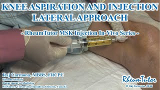 KNEE ASPIRATION  INJECTION LATERAL APPROACH  InVivo Series [upl. by Bonnell]