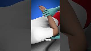 Should Dislocation Treatment  3 D Animation anatomy fracture shortsvideo viralvideo [upl. by Eelarac968]