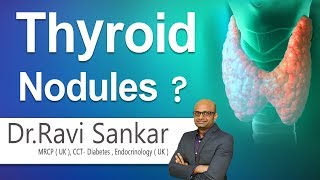 Thyroid Nodules  What are Thyroid nodules  DrRavi Sankar  Endocrinologist  Hi9 [upl. by Eva]