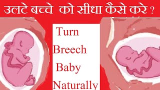 पेट में बच्चा उल्टा होने पर क्या करे Turn Breech Baby Naturally [upl. by Fasano]