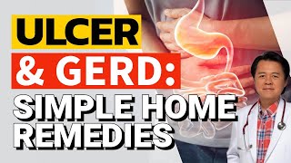 Ulcer and Gerd Simple Home Remedies  By Doctor Willie Ong Internist and Cardiologist [upl. by Lumbard]