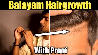 Balayam For Hairgrowth  How To Do Balayam Correctly   How Balayam Helps In Hairgrowth  Hairloss [upl. by Eiffe]