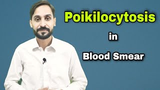 Poikilocytosis  Types of Poikilocytosis  4th Video  Blood Smear Series [upl. by Hanako131]