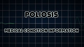 Poliosis Medical Condition [upl. by Ahsoek]