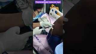 Pleural Tapping l Thoracentesis medical nursing surgery icu procedures trending injection [upl. by Nulubez]