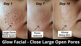 4 Step Glow Facial  Close Large OPEN PORES Remove DARK SPOTS amp get Glowing Skin  Aloevera icecube [upl. by Dodie412]