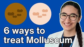 How to treat molluscum contagiosum with Pharmacist Virginia [upl. by Nnauol]