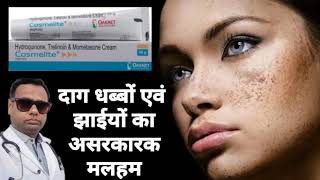 Ointment for melasma। Cosmelite ointment review Hydroquinone Tretinoin amp Mometasone cream। uses। [upl. by Mctyre]