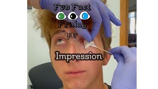 Fun fact Friday Impression For an artificial eye [upl. by Ramsden]