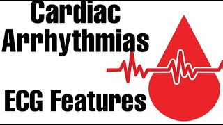 Cardiac Arrhythmiasphysiology part 1  ECGEKG Features  Guyton [upl. by Anwahsad]