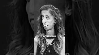 Such a powerful mentality to have…  Lizzie Velasquez X lifetodaytv [upl. by Eillit]