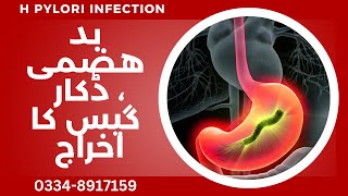 Stomach Low Acidity Hypoacidity amp Gastritis Symptoms and Homeopathic Miasmatic Treatment hpylori [upl. by Annael532]