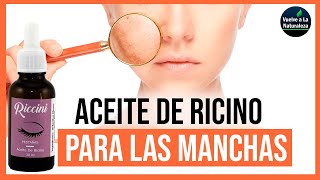 ✅🔴Cómo Utilizar El Aceite De Ricino Para Limpiar Las Manchas De La Cara [upl. by Sara278]