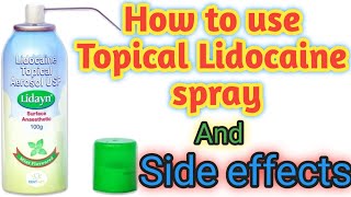 How to use Topical Lidocaine spray And its side effectsDental Bharat [upl. by Zack187]