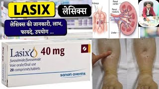 Lasix 40 mg tablet uses in hindi  Lasix Tablet  Furosemide 40 mg [upl. by Araes]