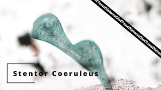 Stentor Coeruleus Splitting [upl. by Collimore]