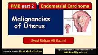 Part 2  PMB  Endometrial hyperplasia  Carcinoma  Sarcoma  Gynecology Review  KML [upl. by Milore914]