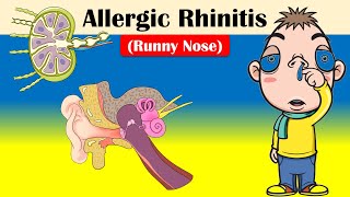 Allergic Rhinitis Runny Nose  Causes Triggering Factors Signs amp Symptoms And Treatment [upl. by Htial130]