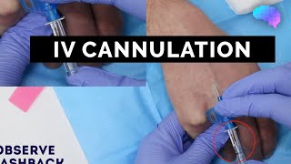 Intravenous IV cannulation  OSCE Guide  UKMLA  CPSA [upl. by Kirby]