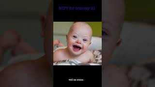 NIPT l Does NIPT help diagnose Down syndrome NIPT [upl. by Kimble665]