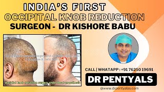 Occipital knob reduction in India  occipital surgery by dr Pentyala’s drpentyalas occipitallift [upl. by Saihttam3]