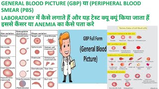 CBC SE GBP या PBS GENERAL BLOOD PICTURE or PERIPHERAL BLOOD SMEAR KI REPORT KAISE BANAYE [upl. by Avlasor155]