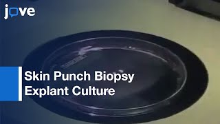 Skin Punch Biopsy Explant Culture For Derivation Primary Human Fibroblasts l Protocol Preview [upl. by Corissa46]