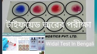 Widal Test Typhoid Paratyphoid Test Widal Test In Bengali Widal Test In BanglaLab Technician Rajib [upl. by Ierna]