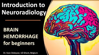 Imaging of Spontaneous Brain Hemorrhage the basics [upl. by Jemmy]