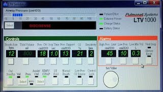 THE SELECT BUTTON ON LTV VENTILATORS EXPLAINED [upl. by Baldwin391]