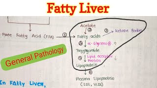 Fatty Liver  Steatosis of Liver  Fatty Change in Liver  General Pathology [upl. by Burbank]