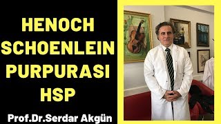 Henoch Schonlein Purpurası HSP Serdar Akgün [upl. by Janina]