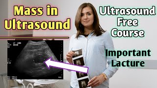 Can masses be seen on ultrasound  Does hypoechoic mass mean cancer [upl. by Ymmac163]