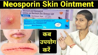 Neomycin and polymyxin b sulfates and bacitracin zinc ointment usp in hindi  neosporin ointment [upl. by Htor]